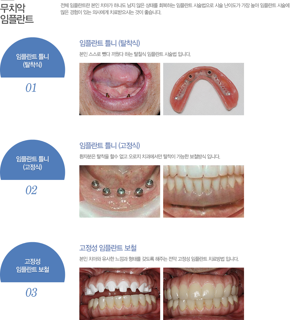 전체 임플란트란 본인 치아가 하나도 남지 않은 상태를 회복하는 임플란트 시술법으로 시술 난이도가 가장 높아 임플란트 시술에 많은 경험이 있는 의사에게 치료받으시는 것이 좋습니다.